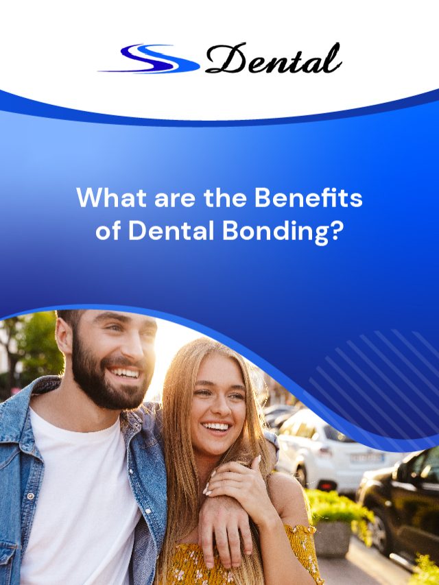 What are the Benefits of Dental Bonding?